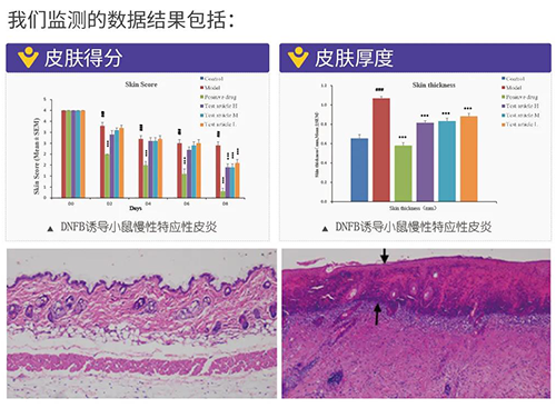 尊龙凯时建立的特应性皮炎及湿疹模型监测数据结果