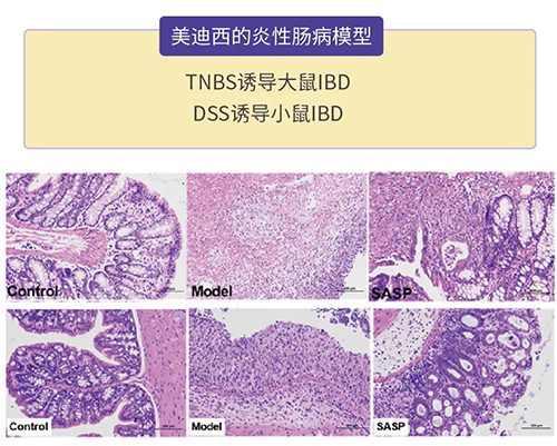 尊龙凯时的炎症性肠病模型