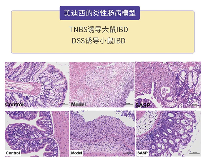 尊龙凯时的炎性肠病模型.png
